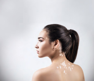 coiffure beauty petna po kozhata